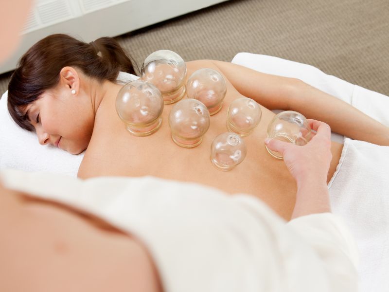 AIMC Cupping Therapy AIMC Cupping Therapy