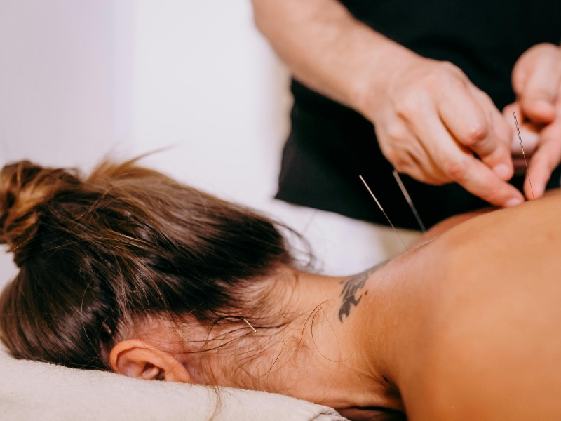 How acupuncture works AIMC How acupuncture works AIMC