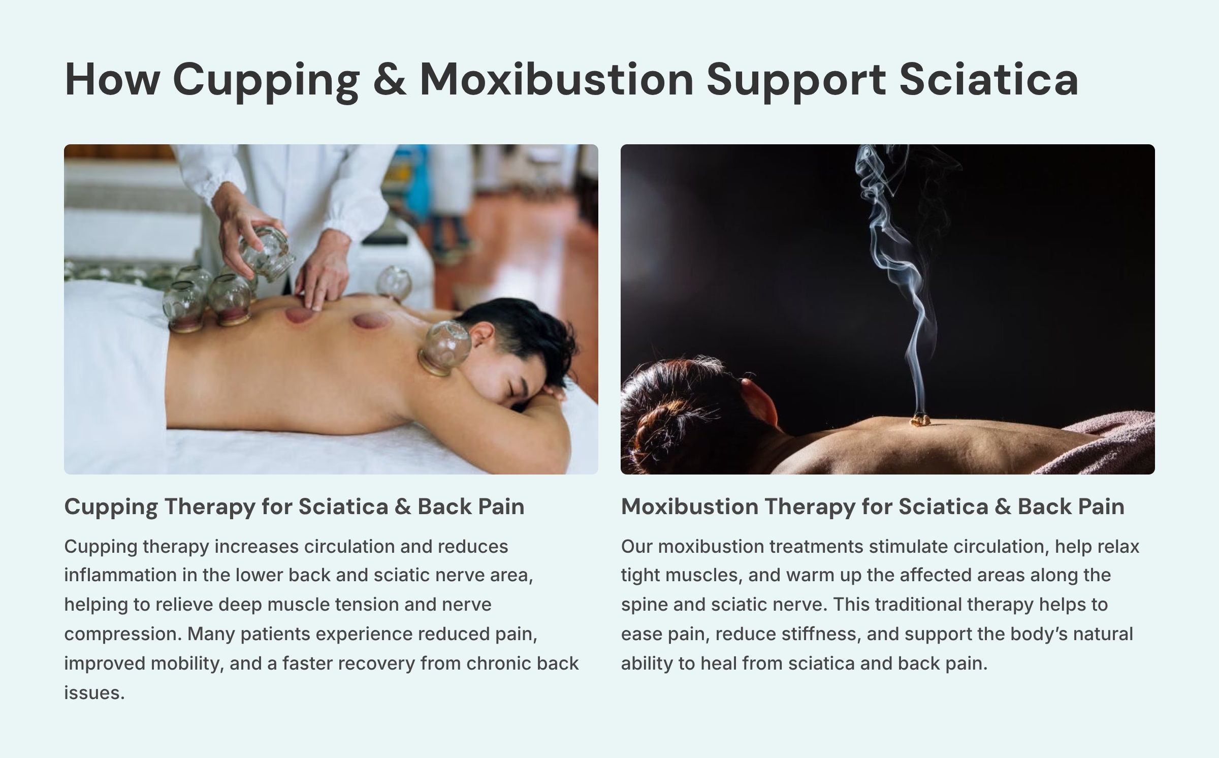 11_How-Cupping-and-Moxibustion-Support-Sciatica
