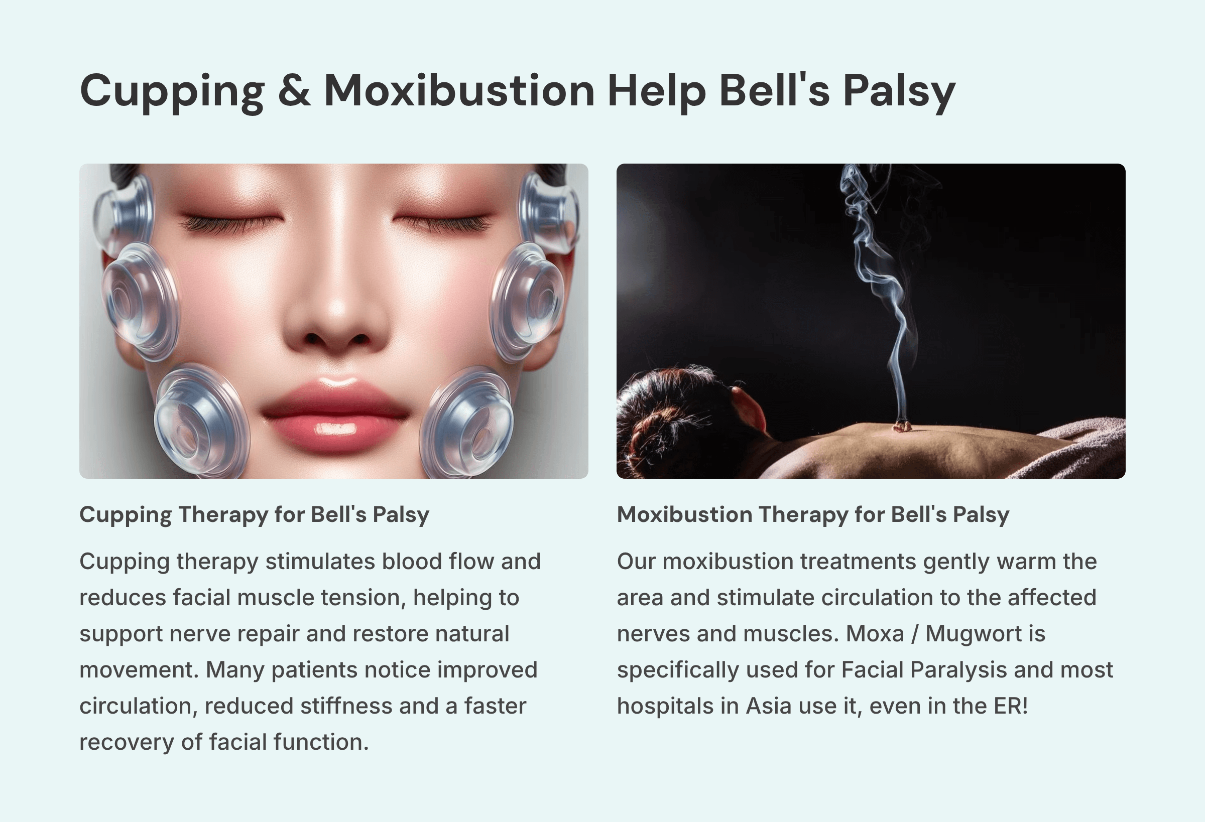 12_Cupping-and-Moxibustion-Help-Bells-Palsy