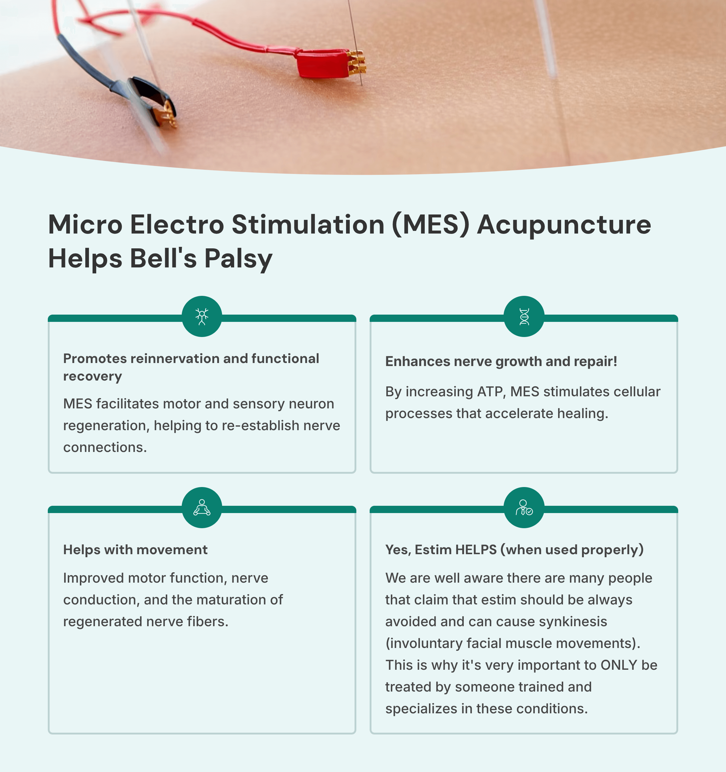 8_Micro-Electro-Stimulation-MES-Acupuncture-Helps-Bells-Palsy