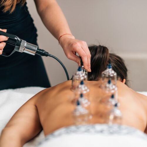 AIMC Clinical Cupping AIMC Clinical Cupping