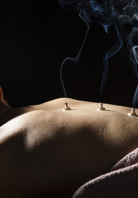 Women put the coals on his back at the spa Women put the coals on his back at the spa