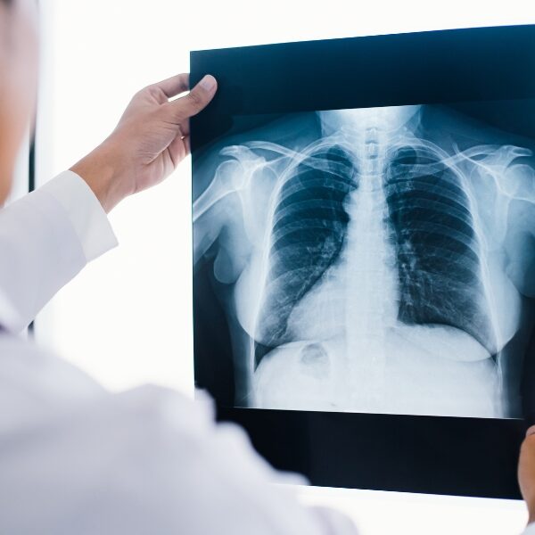 X-Rays AIMC Integrative Medicine Tools X-Rays AIMC Integrative Medicine Tools